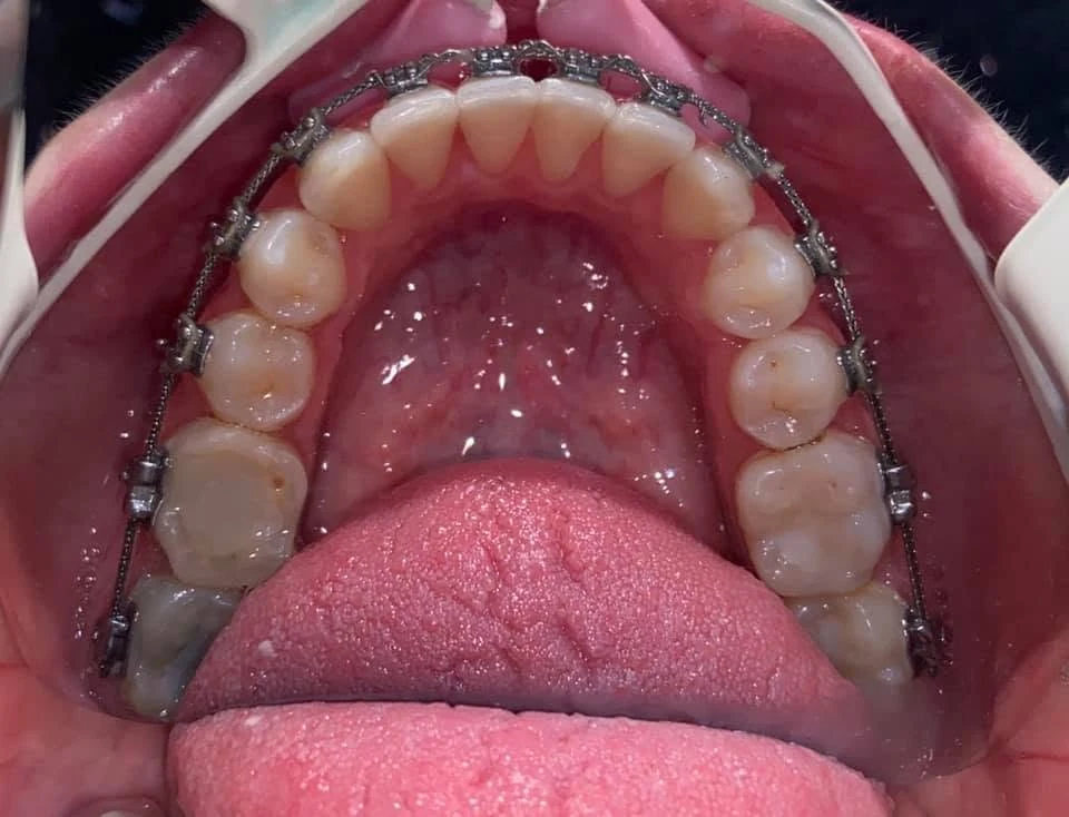 Registro con aparatología, fotografía de referencia de la página de Orthoned
