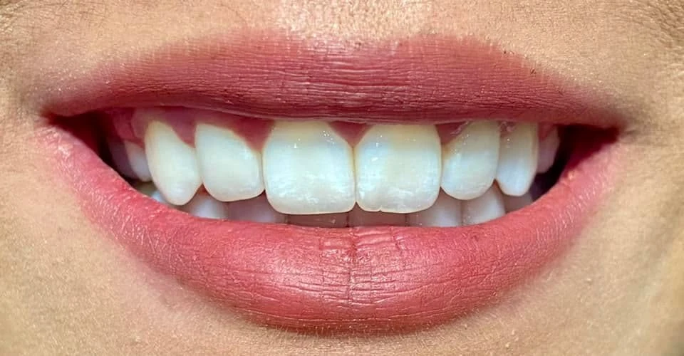 Fotografía de sonrisa publicada por Orthoned
